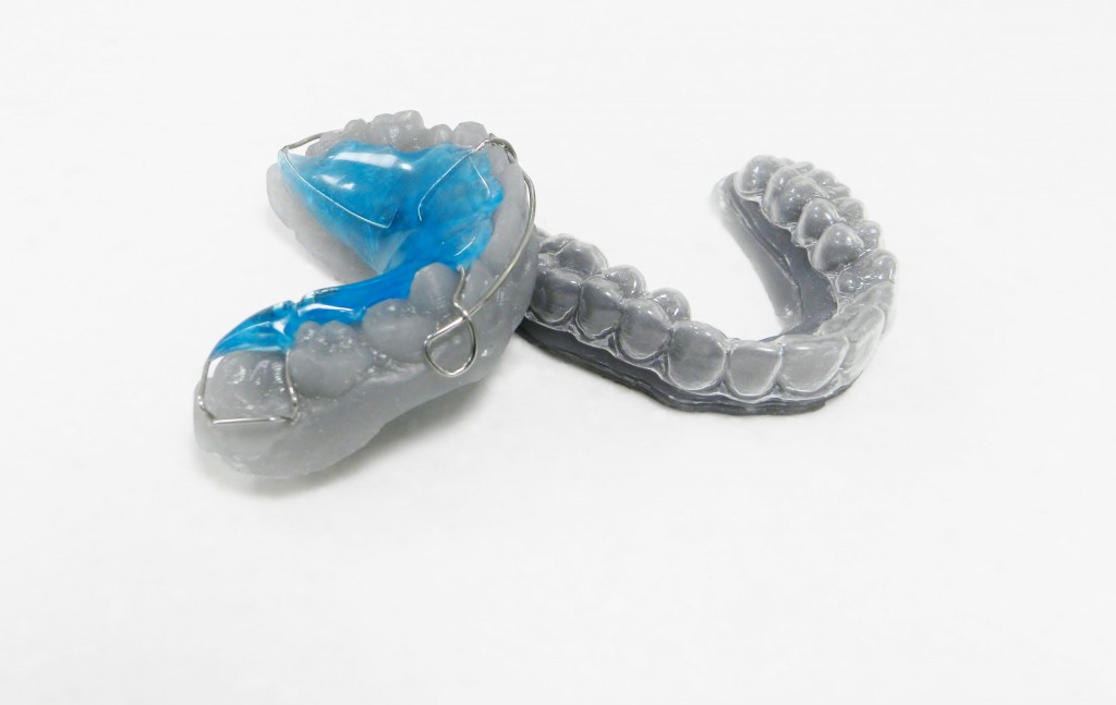 3D Printed Retainers