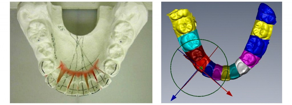 Aligner Sectioning