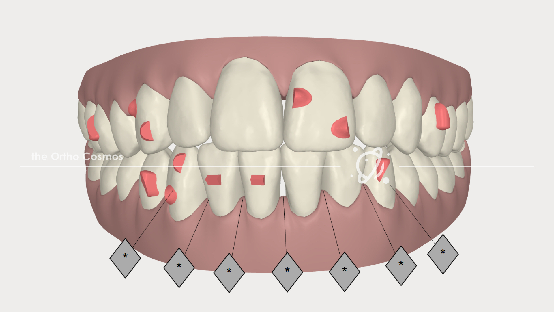 Decoding Invisalign's Optimized Attachment & Optimized Feature Hierarchy -  The Ortho Cosmos