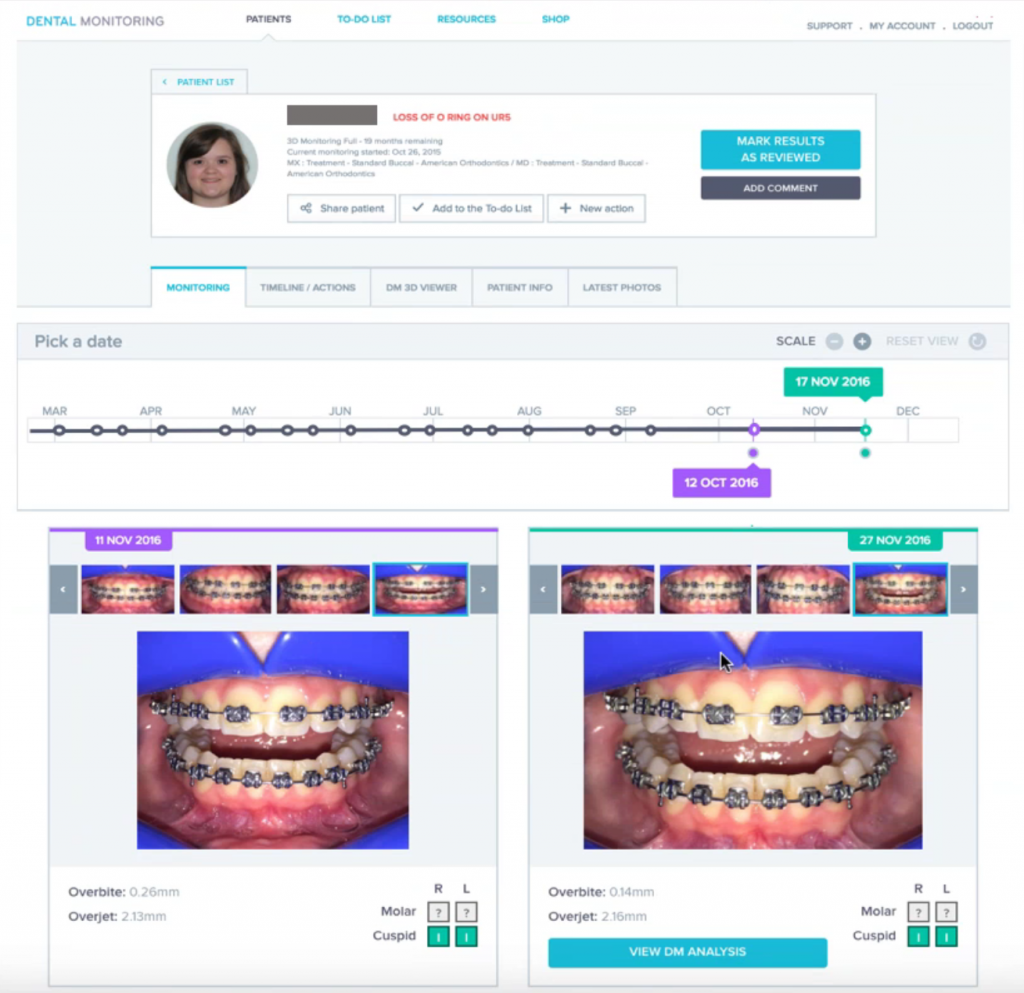 Dental Monitoring Interface