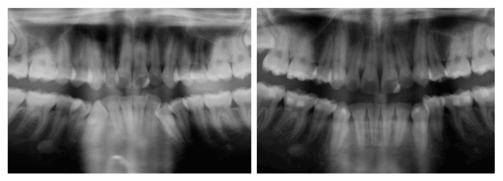 Extracion2 pano