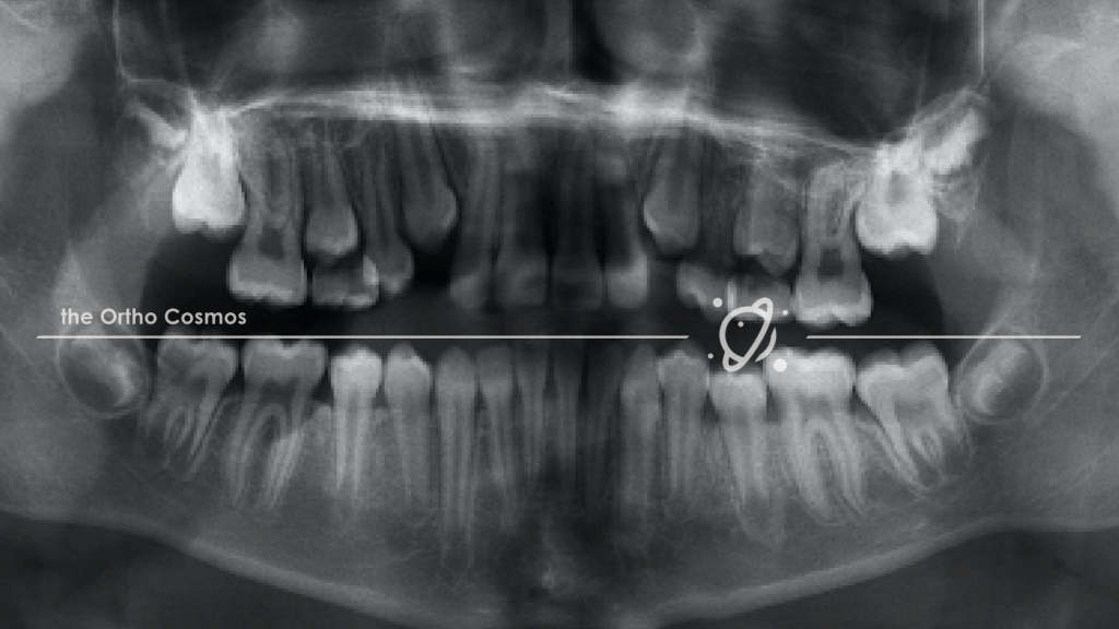 Case 1 pano