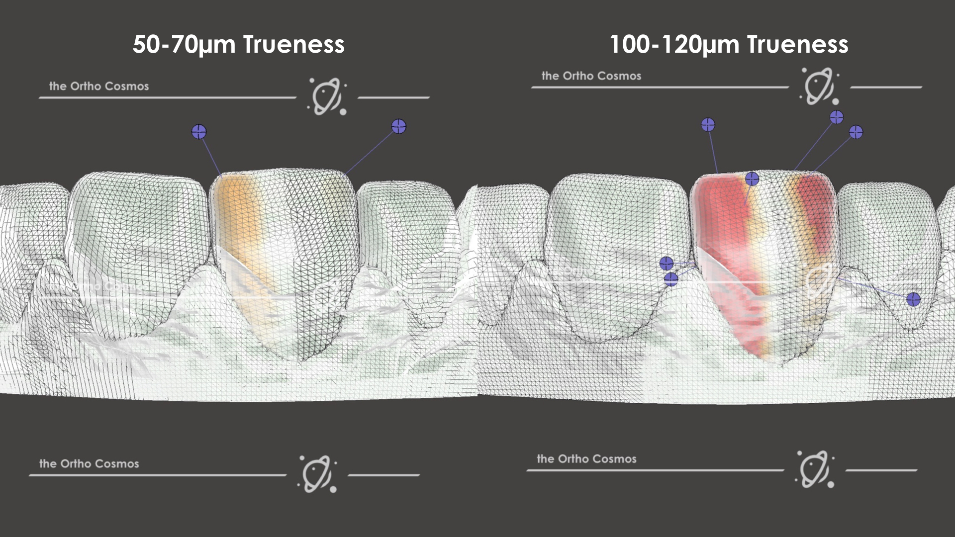 3D Printing Clear Dental Aligners